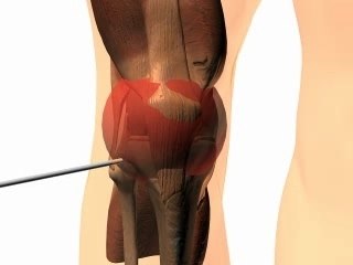 Animation 3D / Lombaire / Genou / SCIENCE