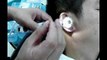 Chinese Ear Cleaning (103) DIY Using ear pick to clean out ear wax
