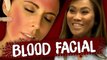 A Bloody Fantastic Facial (BFF) with Beauty Trippin' - YouTube Dr Sandra Lee