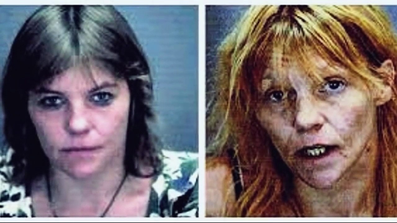 The Horrors of Methamphetamine Addiction