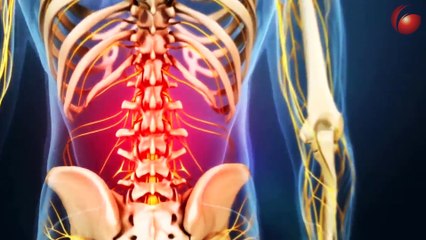 With 8 screws placed in your back you can still...