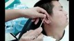 Chinese Ear Cleaning (107) DIY Using goose feather pick to sweep out ear wax
