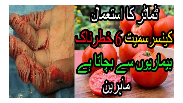 Use tomatoes saves kynsrsmyt 6-threatening diseases, experts
