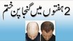 Balon ka Ilaj in Urdu - Bal Lamby Karny Ta Tarika - Hair Loss Treatment - Health and Beauty Tips