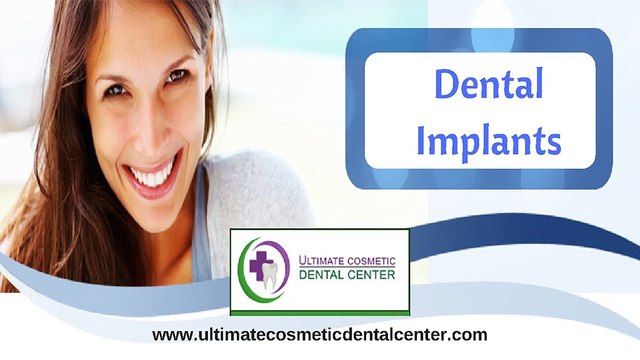 Best Dental Implant Center in Goa | Dental Implants in India