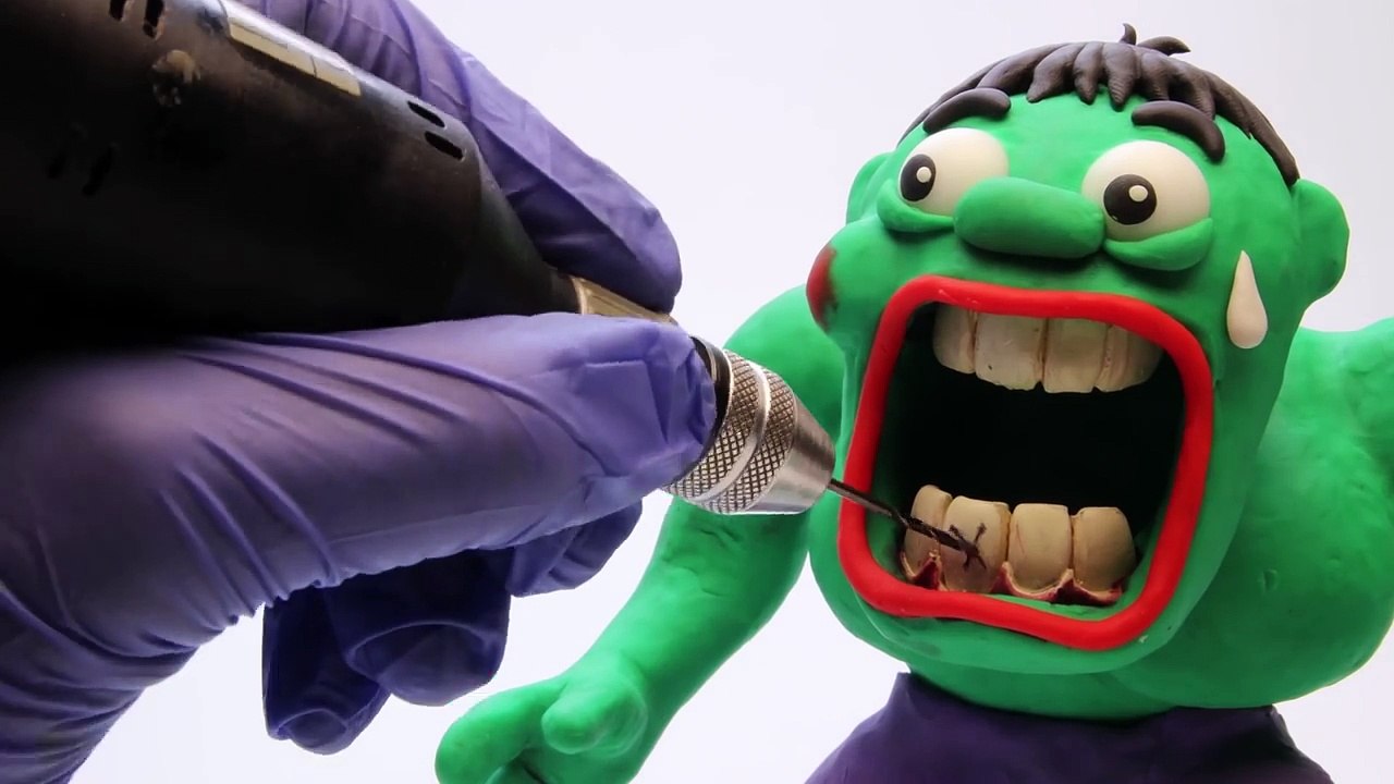 Bloody Hulk Superhero Prank Goes Wrong - Superheroes in Real Life Play Doh Stop Motion