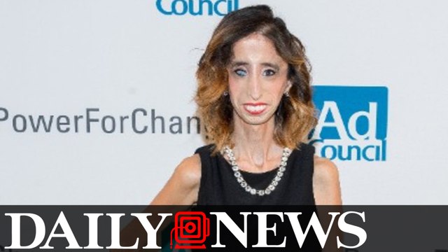 Woman In Cruel Facebook Body-Shaming Meme Speaks Out