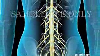 Spinal and Epidural Anesthesia - Medical Video