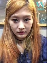 Korea-Plastic-Surgery-Transformation -