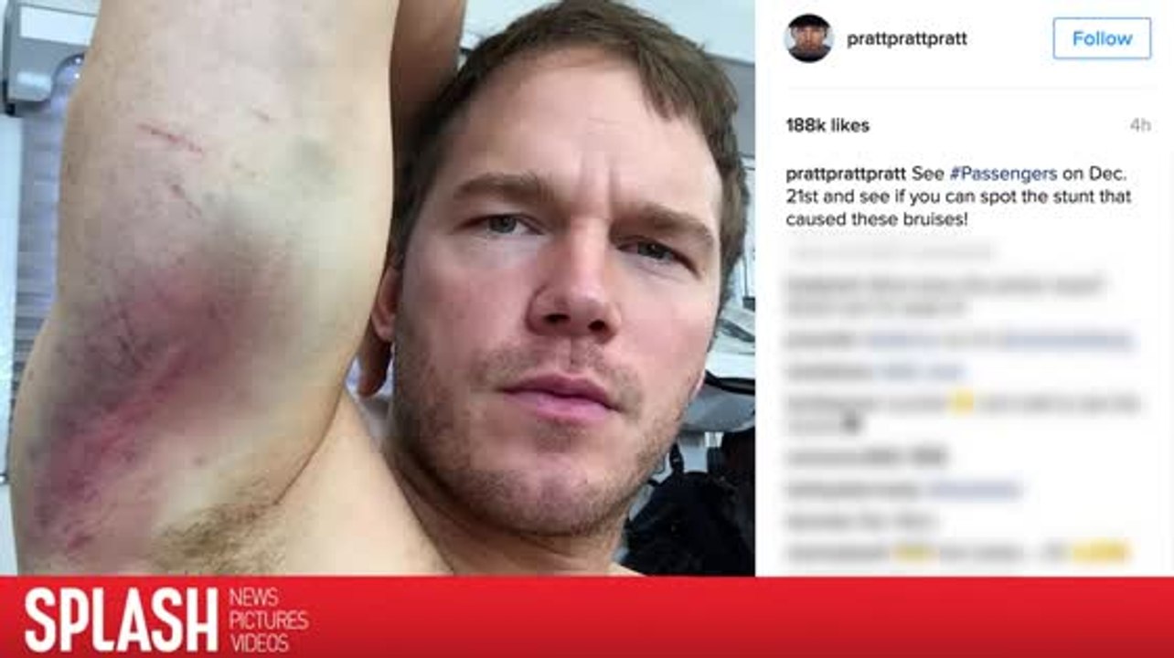 Chris Pratt zeigt seine blauen Flecken von seinen 'Passengers' Stunts