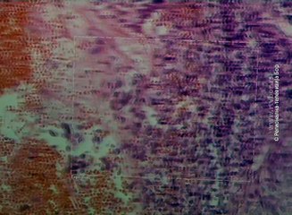 Novi mikroskopi za borsku bolnicu, 25. januar 2017. (RTV Bor)