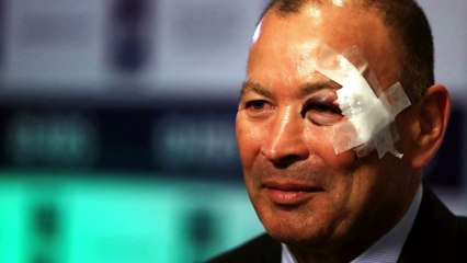 Rugby : le sélectionneur de l’Angleterre sévèrement amoché