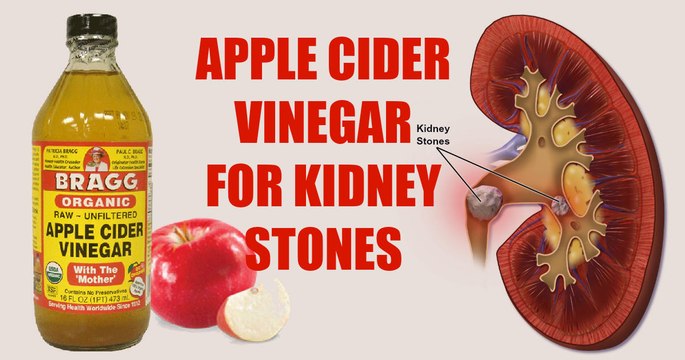 Effective Natural Remedies For Kidney Stones