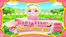 Baby Elsa Skin Allergy Disney Frozen Princes Elsa Doctor Care Game for Kids
