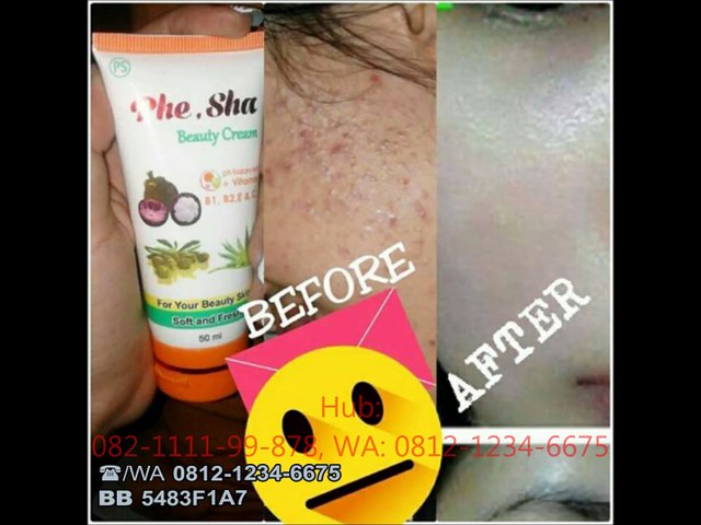 Video Phe Sha Beauty Cream - Dailymotion