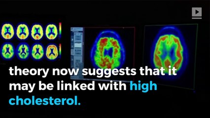 Popular cholesterol medications may protect against Alzheimer’s