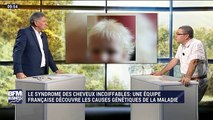 Syndrome des cheveux incoiffables: une équipe française découvre les causes génétiques de la maladie - 17/12