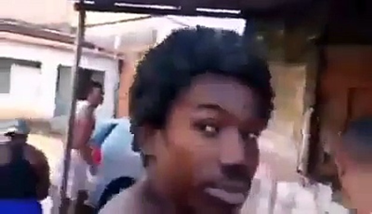 Insolite: il a un serpent dans les cheveux