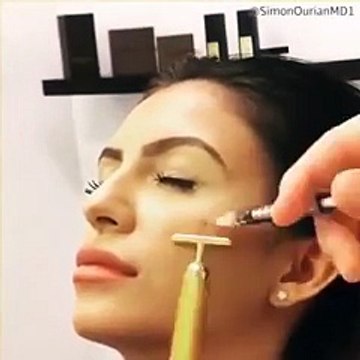 Faryal Makhdoom: Shocking Picture Before & After Surgery