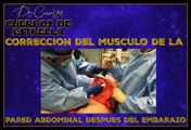 Corrección del músculo de la pared abdominal después del embarazo