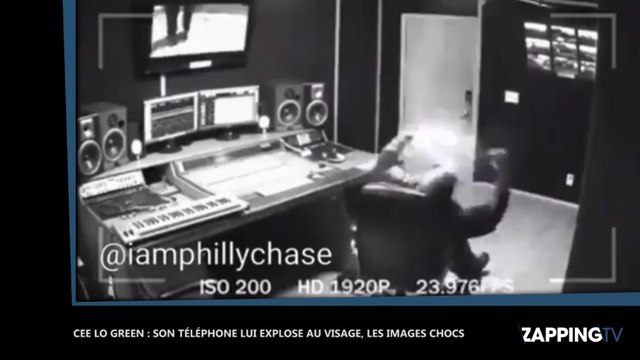 Cee Lo Green : Son téléphone lui explose au visage, les images chocs