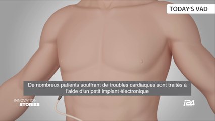 Innovation Stories - Episode 35 | LEVITICUS