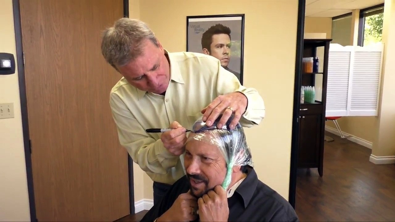 Men's Hair Replacement San Diego Orange County CA