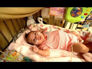 Daleyza fue prematura por lo que presentó hipoplasia pulmonar