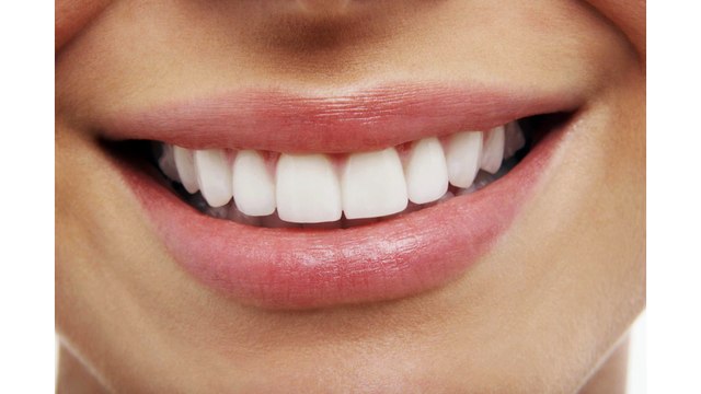 Dental Implant Minneapolis - Reasons to Choose Dental Implants