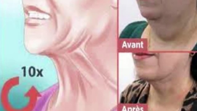 Double Chin Exercises – Learn How To Lose Double Chin And Neck Fat. Double Chin Fast