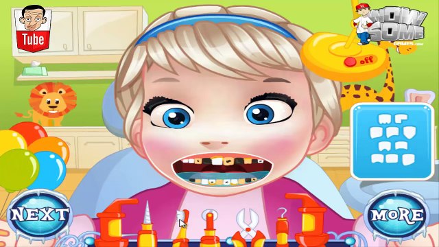 ᴴᴰ ღ Baby Elsa Tooth Problems ღ - Frozen Princess Elsa Baby - Baby Games (ST)