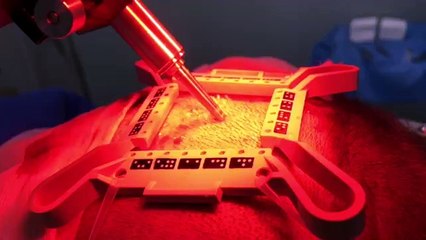 Précision extreme-ARTAS