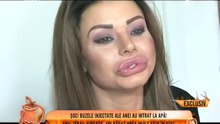 Ana Mocanu, și-a făcut  buze de cal!