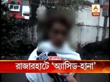 Miscreants throw acid on school girl at Rajarhat
