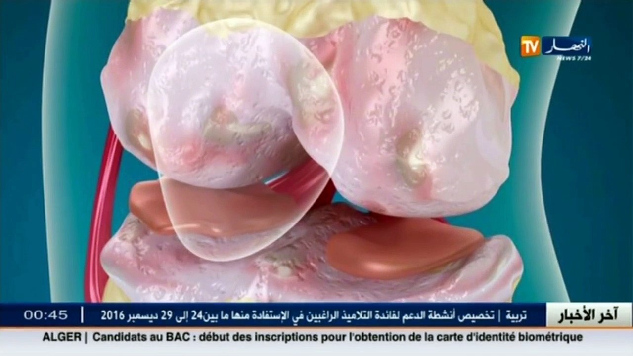 3 دقائق صحة  آلام المفاصل.. أسبابها وكيفية الوق...