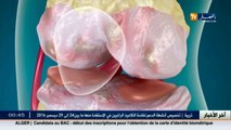3 دقائق صحة  آلام المفاصل.. أسبابها وكيفية الوقاية منها