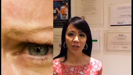 Cutis Wrinkles Treatment