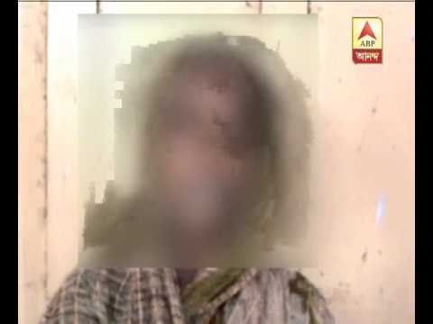 Malda rape attempt victim says, accused inserts rod into father's eye