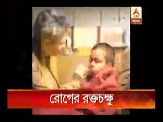 Doctors advice extra caution in changing weather