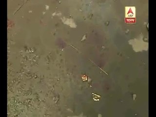 Park Circus:Conductor thrashed school student from the bus, student seriously injured