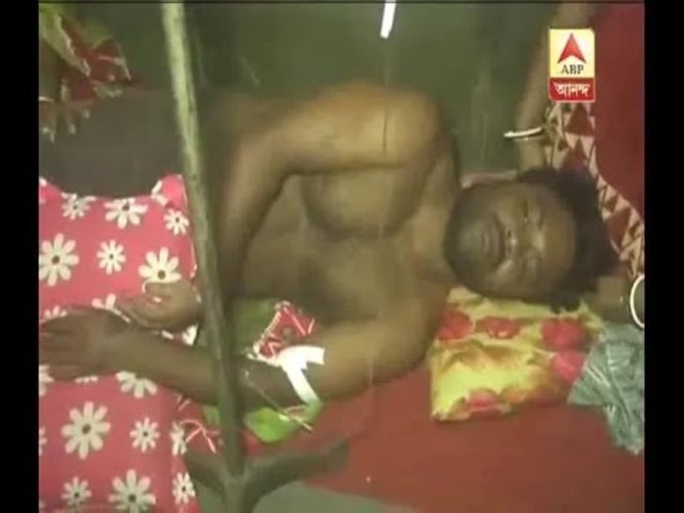 Howrah: Acid attack on a youth