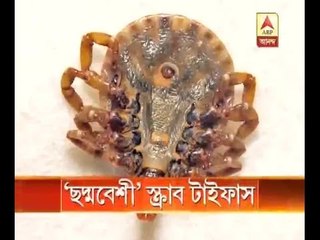 Scrub Typhus disease, symptoms are very similar to Dengue