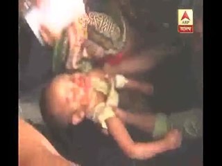Murshidabad Medical College Fire: child injured to come out from inside
