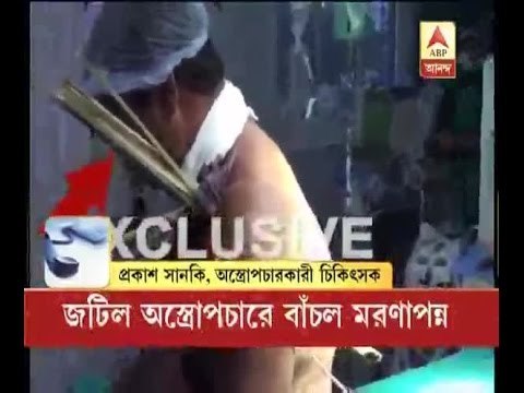 Critical surgery at SSKM saves a dying man's life