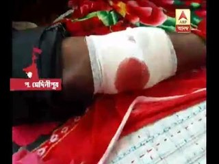 District TMC worker shot at West Midnapore due to inner clash