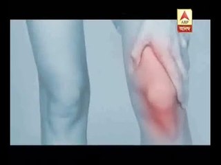 Yogurt will help to cure osteoporosis