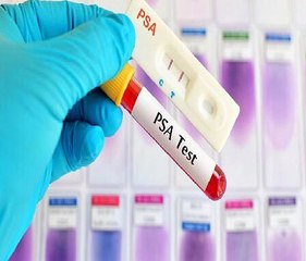 Prostate Cancer Laser Therapy