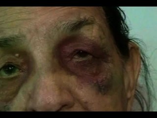 90-year-old ex-Army doctor hit by former UT Home Secretary’s car