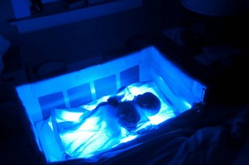 Babica ostavila bebu ispod lampe