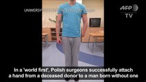 Polish surgeons succesfully attach hand to man born without one